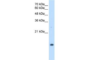 WB Suggested Anti-PPIA Antibody Titration:  2. (PPIA antibody  (Middle Region))