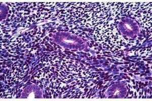 Human Uterus, Endometrium: Formalin-Fixed, Paraffin-Embedded (FFPE) (FANCA antibody  (AA 1121-1170))
