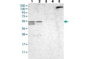 Western blot analysis of Lane 1: RT-4, Lane 2: U-251 MG, Lane 3: Human Plasma, Lane 4: Liver, Lane 5: Tonsil with NDRG3 polyclonal antibody  at 1:250-1:500 dilution.