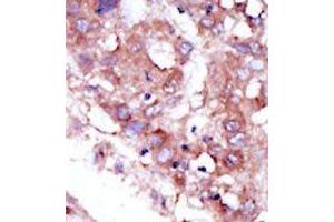 Image no. 1 for anti-serine/threonine Kinase 33 (STK33) (C-Term) antibody (ABIN359942) (STK33 antibody  (C-Term))