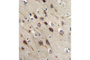 Immunohistochemistry (IHC) image for anti-Brain-Derived Neurotrophic Factor (BDNF) antibody (ABIN3003616)