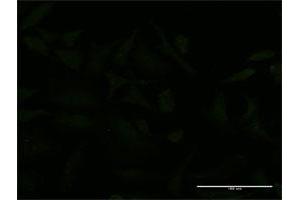 Immunofluorescence of monoclonal antibody to USP9X on HeLa cell. (USP9X antibody  (AA 1-90))