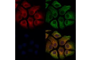 ABIN7093796 and ABIN7097839 staining Hela cells by IF/ICC.