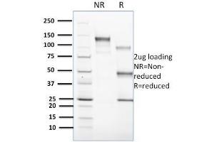 SDS-PAGE Analysis Purified CD1c Mouse Monoclonal Antibody (CD1C/1603). (CD1c antibody)