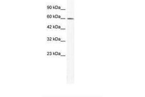 Image no. 1 for anti-Tripartite Motif Containing 3 (TRIM3) (AA 225-274) antibody (ABIN202896) (TRIM3 antibody  (AA 225-274))