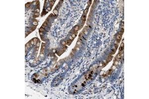 Immunohistochemical staining of human small intestine with GUCA2A polyclonal antibody  strong cytoplasmic positivity in glandular cells. (GUCA2A antibody)