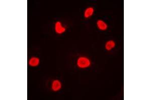 Immunofluorescent analysis of DNA-PKcs staining in MCF7 cells. (PRKDC antibody  (C-Term))
