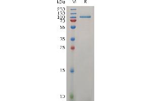 Human L  Protein, His Tag on SDS-PAGE under reducing condition.