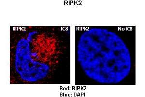 Sample Type :  Rat thyrocytes-FRTL-5   Primary Antibody Dilution :   1:100   Secondary Antibody :  Anti-rabbit-Texas Red   Secondary Antibody Dilution :   1:100   Color/Signal Descriptions :  Red: RIPK2 Blue: DAPI  Gene Name :  RIPK2  Submitted by :  Syed A Morshed, Mount Sinai School of Medicine and James J Peters VA Medical Center (RIPK2 antibody  (Middle Region))