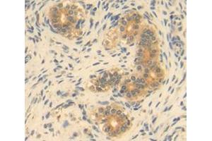 Used in DAB staining on fromalin fixed paraffin- embedded Kidney tissue (GDF9 antibody  (AA 306-440))