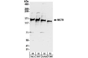 anti-Solute Carrier Family 16 Member 2 (SLC16A2) (AA 250-300) antibody