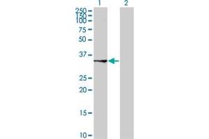 Western Blot analysis of SUCLG1 expression in transfected 293T cell line by SUCLG1 polyclonal antibody (A01). (SUCLG1 antibody  (AA 125-234))