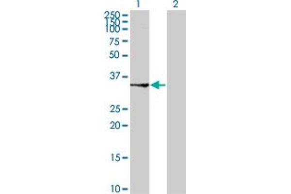 SUCLG1 antibody  (AA 125-234)