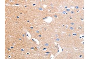 The image on the left is immunohistochemistry of paraffin-embedded Human brain tissue using ABIN7191180(KCNH3 Antibody) at dilution 1/12, on the right is treated with synthetic peptide. (KCNH3 antibody)