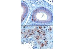 Image no. 1 for anti-Vacuolar Protein Sorting 35 (VPS35) (C-Term) antibody (ABIN374403) (VPS35 antibody  (C-Term))