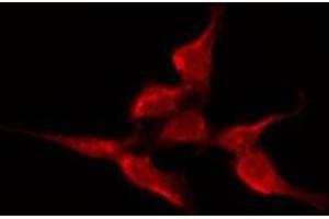 ABIN6275679 staining A549 by IF/ICC. (CACNA1H antibody  (Internal Region))