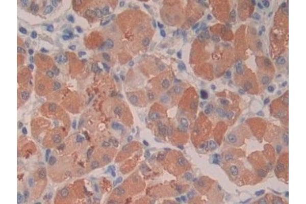 CTX-I antibody