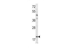 Western blot analysis of Bad BH3 Domain antibody (ABIN388118 and ABIN2846287) in mouse bladder tissue lysates (35 μg/lane). (BAD antibody  (AA 92-127))