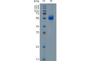 SDS-PAGE (SDS) image for CD33 (CD33) (AA 140-259) protein (Fc Tag) (ABIN7092843)