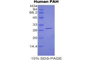 SDS-PAGE (SDS) image for Fumarylacetoacetate Hydrolase (Fumarylacetoacetase) (FAH) (AA 189-419) protein (His tag) (ABIN2121093)