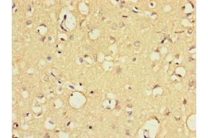 Immunohistochemistry of paraffin-embedded human brain tissue using ABIN7152265 at dilution of 1:100 (Exonuclease 1 antibody  (AA 301-600))