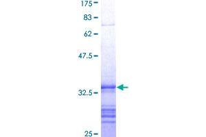 ADAM10 Protein (AA 346-435) (GST tag)