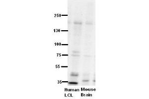 WB Suggested Anti-ZNF294 Antibody Titration:  5% Milk  ELISA Titer:  dilution: 1:500  Positive Control:  human LCL and mouse brains