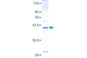 Image no. 1 for Claudin 4 (CLDN4) (AA 1-209) protein (GST tag) (ABIN1349615) (Claudin 4 Protein (CLDN4) (AA 1-209) (GST tag))