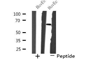 Western blot analysis of extracts from HuvEc cells, using SH2B2 antibody. (SH2B2 antibody  (N-Term))