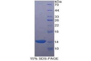 SDS-PAGE (SDS) image for Agouti Related Protein Homolog (Mouse) (AGRP) (AA 20-130) protein (His tag) (ABIN2120485)