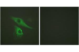 Immunofluorescence analysis of HeLa cells, using Keratin 8 (Ab-73) Antibody. (KRT8 antibody  (AA 41-90))