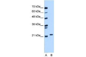 WB Suggested Anti-RAB11B Antibody Titration:  0.