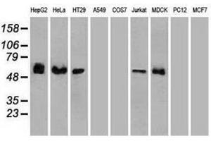 Image no. 6 for anti-Checkpoint Kinase 2 (CHEK2) antibody (ABIN1497499) (CHEK2 antibody)