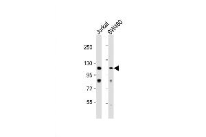 Western Blot at 1:1000 dilution Lane 1: Jurkat whole cell lysate Lane 2: SW480 whole cell lysate Lysates/proteins at 20 ug per lane. (MAP3K9 antibody  (C-Term))