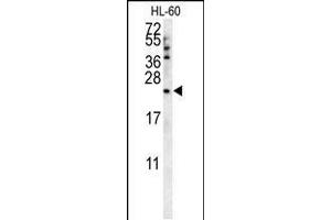 Western blot analysis in HL-60 cell line lysates (35ug/lane). (Coq7 antibody  (C-Term))
