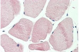 Human Skeletal Muscle: Formalin-Fixed, Paraffin-Embedded (FFPE) (GAPDH antibody  (AA 107-156))