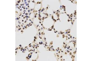 Immunohistochemistry of paraffin-embedded mouse lung using Asymmetric DiMethyl-Histone H3-R17 antibody (ABIN1872982) at dilution of 1:200 (40x lens). (Histone 3 antibody  (H3R17me2a))