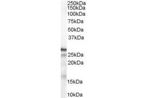 ABIN184587 (1µg/ml) staining of Human Breast lysate (35µg protein in RIPA buffer). (CDKN1B antibody  (C-Term))