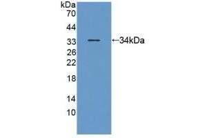 Detection of Recombinant ANTXR2, Human using Polyclonal Antibody to Anthrax Toxin Receptor 2 (ANTXR2) (ANTXR2 antibody  (AA 34-318))