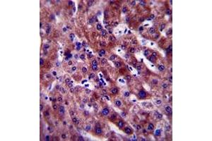Immunohistochemistry analysis in formalin fixed and paraffin embedded human liver tissue reacted with PON1 Antibody (Center) followed which was peroxidase conjugated to the secondary antibody and followed by DAB staining. (PON1 antibody  (Middle Region))