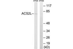 Western blot analysis of extracts from HT-29 cells, using ACSS1 Antibody. (ACSS1 antibody)
