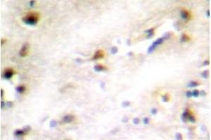 Image no. 2 for anti-ZFP36 Ring Finger Protein-Like 1 (ZFP36L1) antibody (ABIN317801) (ZFP36L1 antibody)