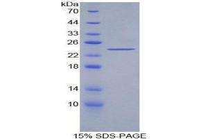 SDS-PAGE (SDS) image for Acetylcholinesterase (AChE) (AA 377-574) protein (His tag) (ABIN1098807) (Acetylcholinesterase Protein (AChE) (AA 377-574) (His tag))