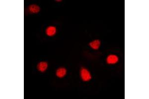 Immunofluorescent analysis of hnRNP G staining in Jurkat cells. (RBMX antibody  (N-Term))