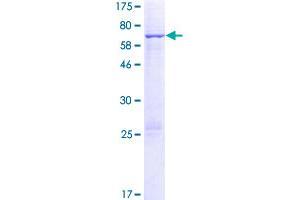 Image no. 1 for Fanconi Anemia, Complementation Group F (FANCF) (AA 1-374) protein (GST tag) (ABIN1353631) (FANCF Protein (AA 1-374) (GST tag))