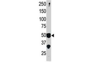 The SETD7 polyclonal antibody  is used in Western blot to detect SET9 in mouse brain tissue lysate.