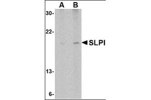 Western blot analysis of SLPI in Daudi cell lysate with this product at (A) 1 and (B) 2 μg/ml. (SLPI antibody  (Center))