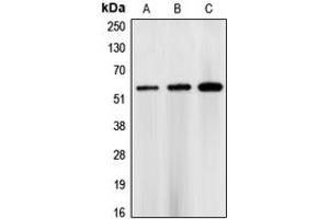 Western blot analysis of CHK1 expression in HEK293T (A), NIH3T3 (B), rat heart (C) whole cell lysates. (CHEK1 antibody  (Center))