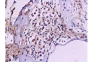 Formalin-fixed and paraffin embedded rat cochlea tissue labeled Anti-NF-M/Neurofilament M Polyclonal Antibody, Unconjugated (ABIN672186) at 1:200, followed by conjugation to the secondary antibody and DAB staining (NEFM antibody  (AA 101-200))