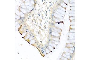 Immunohistochemistry of paraffin-embedded human colon using CPA1 antibody. (CPA1 antibody)
